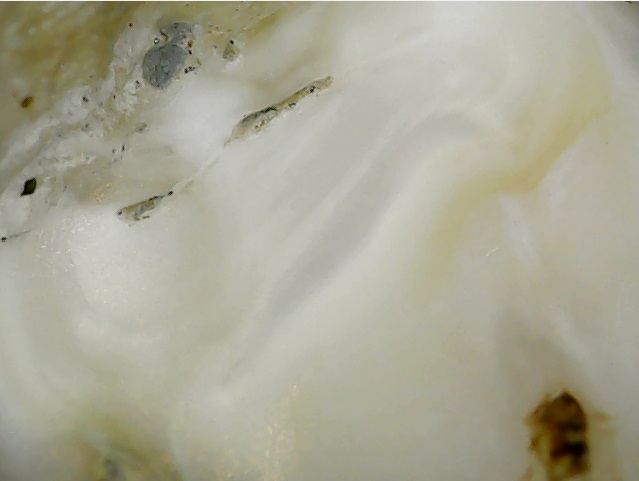 Vue microscopique des couches de cément